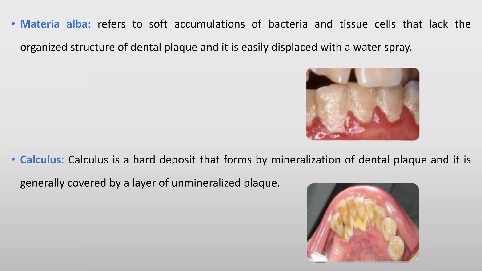 Anti plaque agents, Dr Sai Lakshmi | PPT
