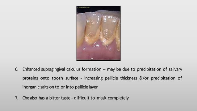 Anti plaque agents, Dr Sai Lakshmi | PPT