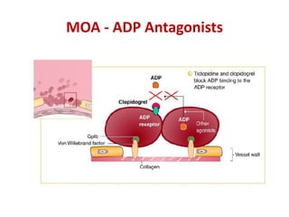MOA - ADP Antagonists
 