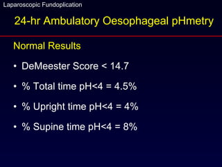 Normal Results DeMeester Score < 14.7 % Total time pH<4 = 4.5% % Upright time pH<4 = 4% % Supine time pH<4 = 8% 24-hr Ambulatory Oesophageal pHmetry 