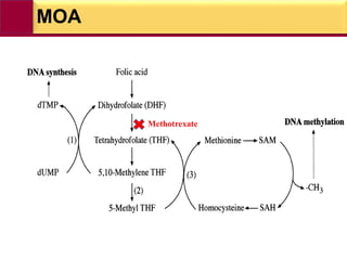 MOA
Methotrexate
 
