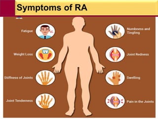 Symptoms of RA
 