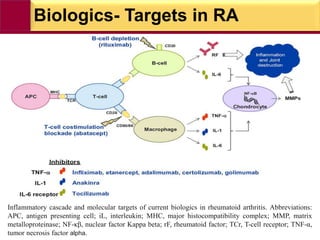 Biologics- Targets in RA
Inflammatory cascade and molecular targets of current biologics in rheumatoid arthritis. Abbreviations:
APC, antigen presenting cell; iL, interleukin; MHC, major histocompatibility complex; MMP, matrix
metalloproteinase; NF-κβ, nuclear factor Kappa beta; rF, rheumatoid factor; TCr, T-cell receptor; TNF-α,
tumor necrosis factor alpha.
 