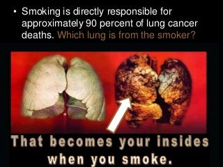 • Smoking is directly responsible for
approximately 90 percent of lung cancer
deaths. Which lung is from the smoker?
 