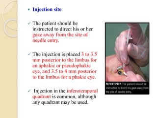 Limbus Injected Anti vegf' s in Ophthalmology | PPTX