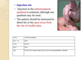  Injection site
 Injection in the inferotemporal
quadrant is common, although any
quadrant may be used.
 The patient should be instructed to
direct his or her gaze away from
the site of needle entry.
1-6 m. 1.5mm from limbus
6 m. - 1y. 2mm
1-2 y. 2.5 mm
2-6 y. 3mm
>6y. 3.5 to 4 mm in phakic eyes and 3 to 3.5 mm in pseudophakic or aphakic.
 
