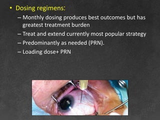 • Dosing regimens:
– Monthly dosing produces best outcomes but has
greatest treatment burden
– Treat and extend currently most popular strategy
– Predominantly as needed (PRN).
– Loading dose+ PRN
 