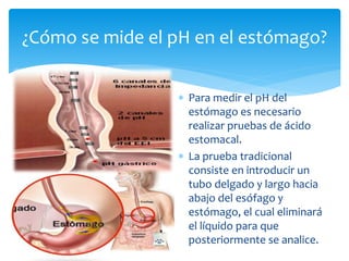 Antiacidos y balance del pH en el estomago | PPTX | Digestive Disorders ...