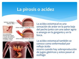 La pirosis o acidez
La acidez estomacal es una
sensación de ardor en la parte baja
del pecho junto con una sabor agrio
o a...