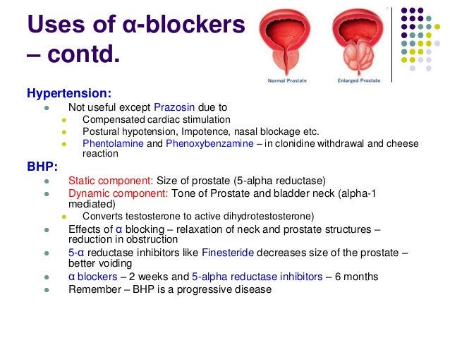 Antiadrenergic drugs - drdhriti Antiadrenergic drugs - drdhriti