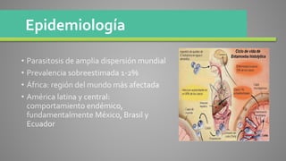 Epidemiología
 