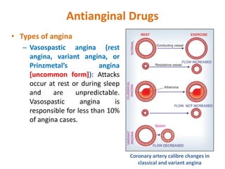 Antianginal Drugs
• Types of angina
– Vasospastic angina (rest
angina, variant angina, or
Prinzmetal’s angina
[uncommon form]): Attacks
occur at rest or during sleep
and are unpredictable.
Vasospastic angina is
responsible for less than 10%
of angina cases.
Coronary artery calibre changes in
classical and variant angina
 