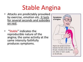 Stable Angina
• Attacks are predictably provoked
by exercise, emotion etc. It lasts
for several seconds and subsides
on rest.
• “Stable” indicates the
reproducible nature of the
angina; the same activity at the
same intensity faithfully
produces symptoms.
 