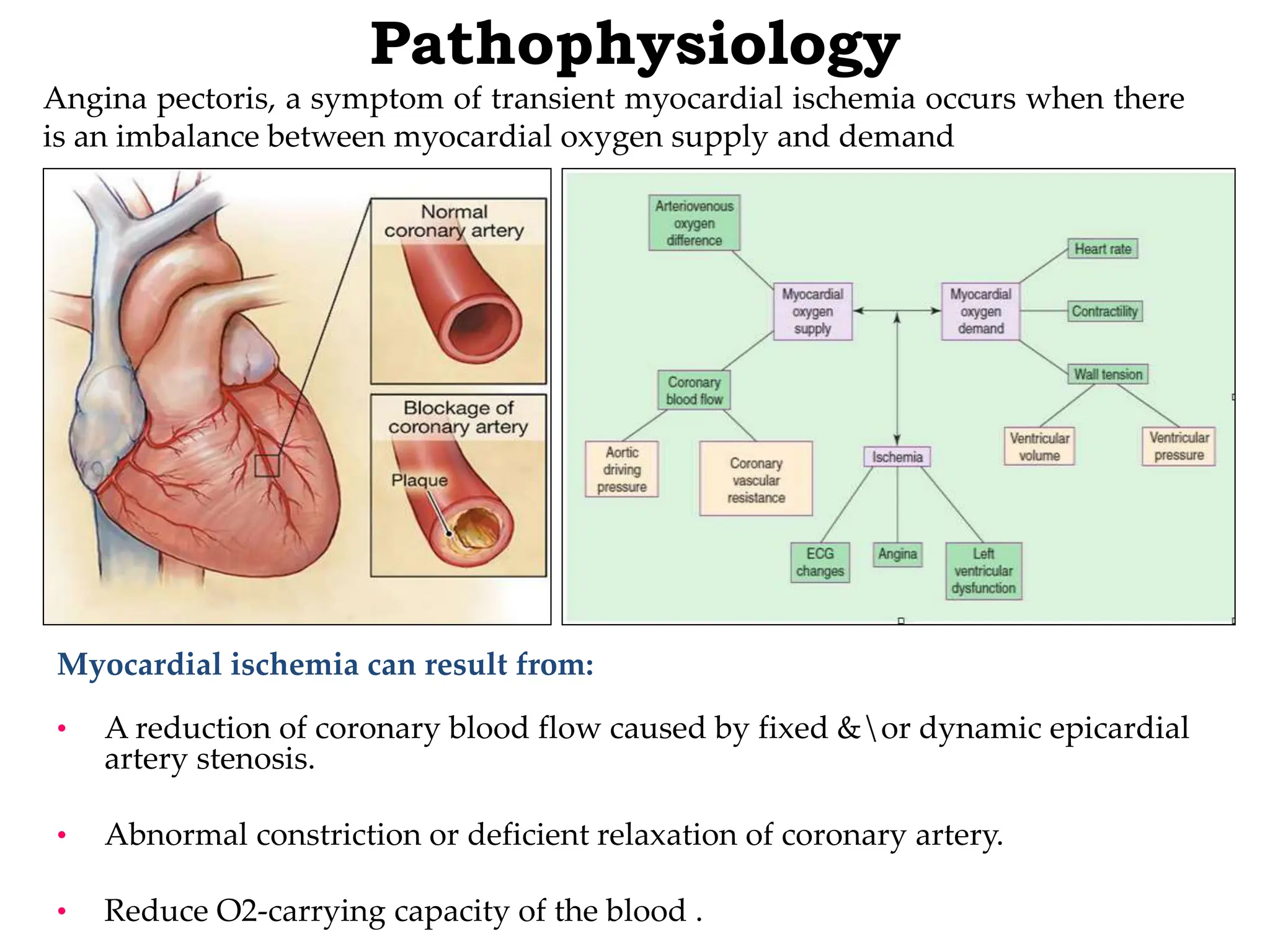 Angina Pectoris and Antianginal Drugs_Kamal.pptx