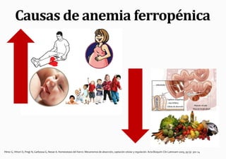 Causas de anemia ferropénica




Pérez G, Vittori D, Pregi N, Garbossa G, Nesse A. Homeostasis del hierro: Mecanismos de absorción, captación celular y regulación. Acta Bioquím Clín Latinoam 2005; 39 (3): 301-14
 