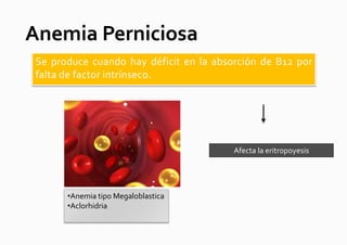 Anemia Perniciosa
 Se produce cuando hay déficit en la absorción de B12 por
 falta de factor intrínseco.




                                         Afecta la eritropoyesis




       •Anemia tipo Megaloblastica
       •Aclorhidria
 