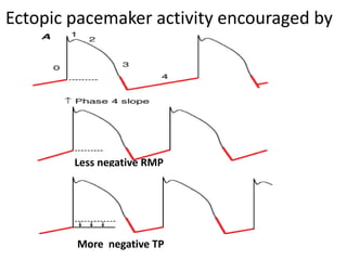 Less negative RMP
More negative TP
Ectopic pacemaker activity encouraged by
 