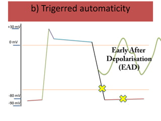 b) Trigerred automaticity
+30 mV
0 mV
-80 mV
-90 mV
 
