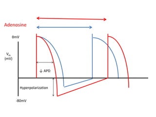 Vm
(mV)
-80mV
0mV
↓ APD
Hyperpolarization
Adenosine
 