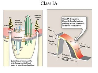 Class IA
 