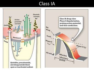 Class IA
 