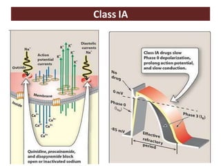 Class IA
 