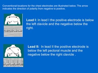Antiarrhythmic drugs class Bidya.pdf