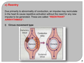 c) Reentry
Due primarily to abnormality of conduction, an impulse may recirculate
in the heart & cause repetitive activation without the need for any new
impulse to be generated. These are called “REENTRANT
ARRHYTHMIAS”.
i) Circus movement type
7
 