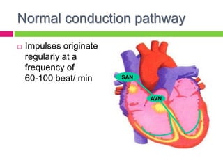 SAN
AVN
Impulse conductionNormal conduction pathway
 Impulses originate
regularly at a
frequency of
60-100 beat/ min
 