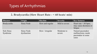 Mode of action ANTIARRHYTHMICS presentation | PPTX