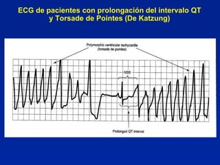 ECG de pacientes con prolongación del intervalo QT
        y Torsade de Pointes (De Katzung)
 