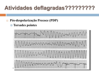 Atividades deflagradas?????????Pós-despolarização Precoce (PDP)Torsadespointes
