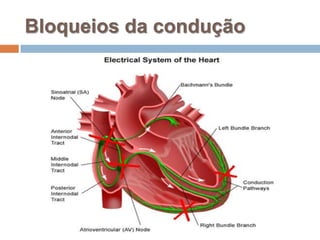 Bloqueios da condução