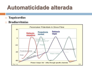 Automaticidade alteradaTaquicardiasBradiarritmias