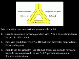 Pré- requisitos para uma arritmia de reentrada inclui:
1. Circuito anatômico formado por duas vias (Alfa e Beta) alimentadas
por um circuito comum
2. Duas vias condutoras (ALFA e BETA) com diferentes propriedades
eletrofisioló-gicas
3. Quando um dos circuitos (via BETA) possui um periodo refratário
maior do que o observado na via ALFA,permitindo assim um
bloqueio unidirecional.
 