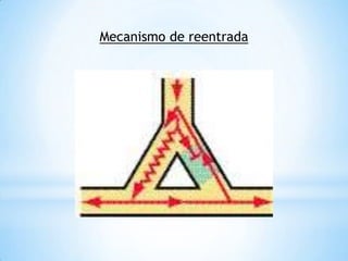 Mecanismo de reentrada
 