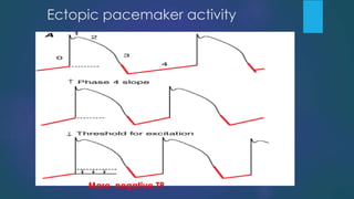 Less negative RMP
More negative TP
Ectopic pacemaker activity
 