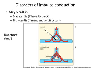 Disorders of impulse conduction
• May result in
– Bradycardia (if have AV block)
– Tachycardia (if reentrant circuit occurs)
Reentrant
circuit
 