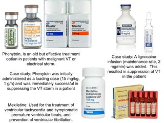 Phenytoin, is an old but effective treatment
option in patients with malignant VT or
electrical storm.
Case study: Phenytoin was initially
administered as a loading dose (15 mg/kg,
1 g/h) and was immediately successful in
suppressing the VT storm in a patient
Case study: A lignocaine
infusion (maintenance rate, 2
mg/min) was added. This
resulted in suppression of VT
in the patient
Mexiletine: Used for the treatment of
ventricular tachycardia and symptomatic
premature ventricular beats, and
prevention of ventricular fibrillation.
 