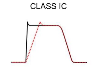 CLASS IC
 