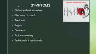 z SYMPTOMS
 Fluttering chest sensation
 Shortness of breath
 Tiredness
 Angina
 Dizziness
 Profuse sweating
 Tachycardia &Bradycardia
 