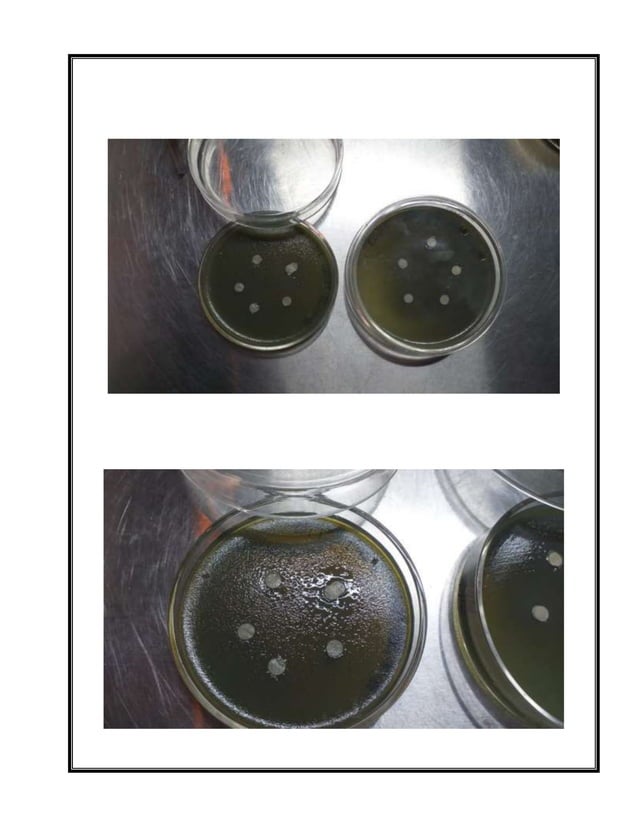 Antibacterial activity of honey on pseudomonas species
