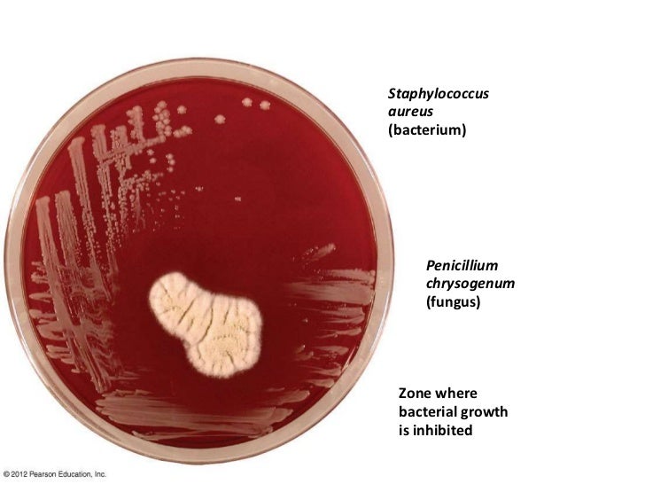 Penicillium Chrysogenum Mold Cure Naturally Penicillium Chrysogenum Mold Cure Naturally