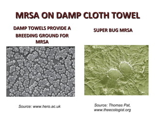 MRSA ON DAMP CLOTH TOWEL
DAMP TOWELS PROVIDE A     SUPER BUG MRSA
 BREEDING GROUND FOR
        MRSA




 Source: www.hero.ac.uk   Source: Thomas Pat,
                          www.theecologist.org
 