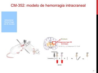 31
Intracranial
Hemorrhage
(rat & mouse)
Collagenase type VII
(0.2 U/µL)
Striatum
CM-352 IC50 vs Collagenase VII >10mM
Collagenase
VII
Craneotomy 1h
MRI MRI
2h
CM-352
2h 19h 14d
MRI MRI
CM-352: modelo de hemorragia intracraneal
 