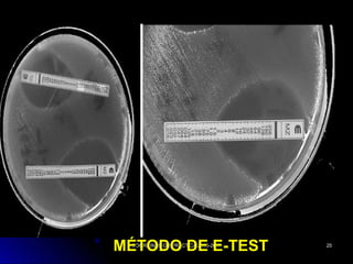 COORDINACION PRACTICA 2006-2007COORDINACION PRACTICA 2006-2007 2525
MÉTODO DE E-TESTMÉTODO DE E-TEST
 