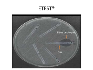 ETEST®
Elipse de diluição
CIM
 