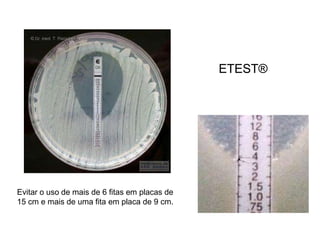 Evitar o uso de mais de 6 fitas em placas de
15 cm e mais de uma fita em placa de 9 cm.
ETEST®
 