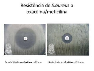 Resistência de S.aureus a
oxacilina/meticilina
Sensibilidade a cefoxitina : ≥22 mm Resistência a cefoxitina: ≤ 21 mm
 