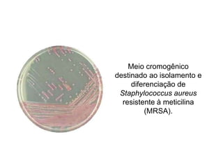 Meio cromogênico
destinado ao isolamento e
diferenciação de
Staphylococcus aureus
resistente à meticilina
(MRSA).
 